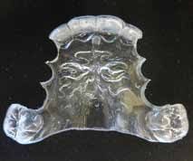 Colorful Phase 1 retainer designed for early treatment patients